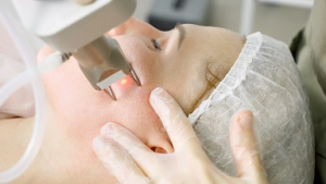 عکس کلینیک اپیلاسیون و لیزر روی صورت زنانه